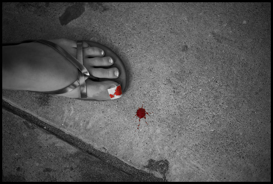 Accident